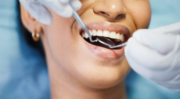 Best Knocked-Out Tooth (Avulsed Tooth) Treatment in Weatherly, PA