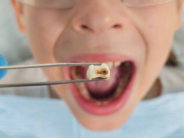 Best Urgent Dental Care for Toothaches in Weatherly, PA